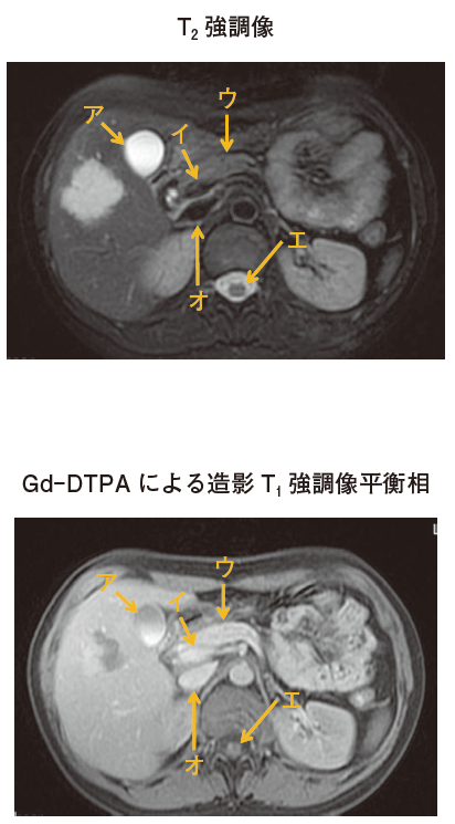 問題画像