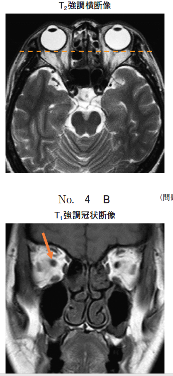問題画像