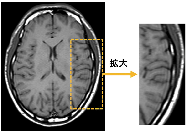 問題画像