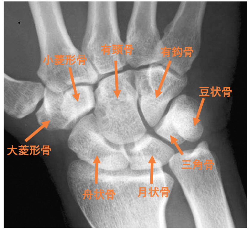 手根骨
